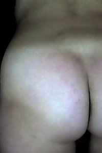 a absorbs chicks has a penis on her back